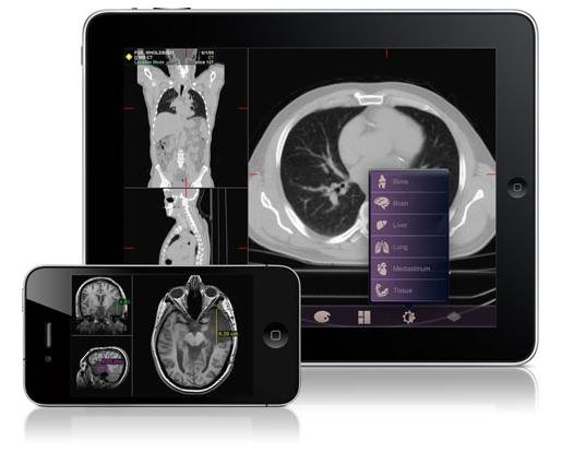 FDAͨ^ׂ(g)t(y)\(yng)óMobile MIM